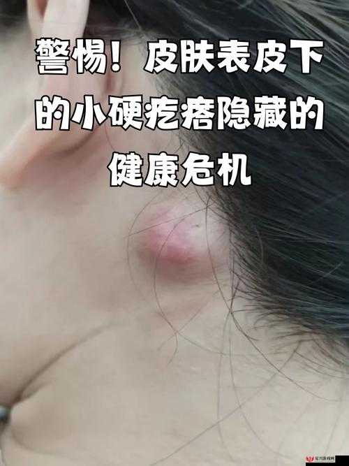 都湿透了还嘴硬疼咋回事：探寻背后隐藏的健康问题